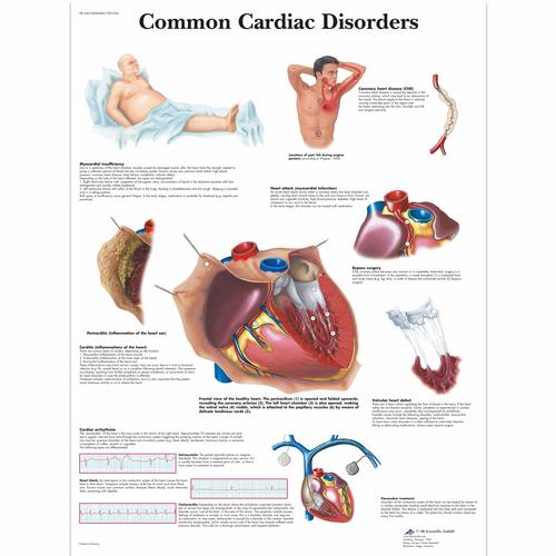 VR1343UU: Common Cardiac