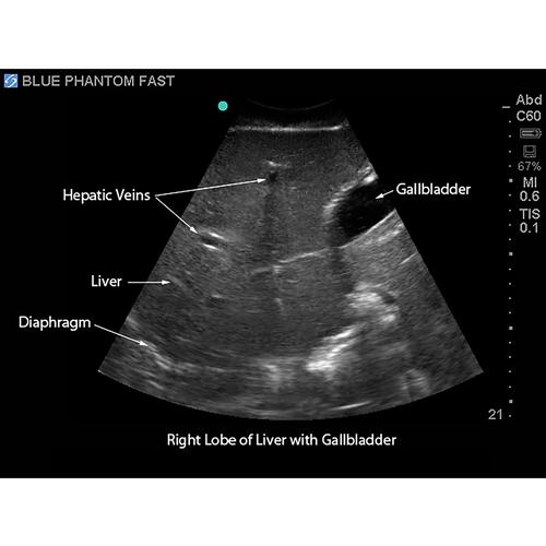 Blue Phantom FAST Ultrasound Training Model Includes Full Body Torso ...