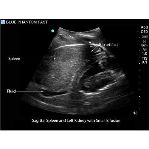 Blue Phantom FAST Ultrasound Training Model Includes Full Body Torso ...