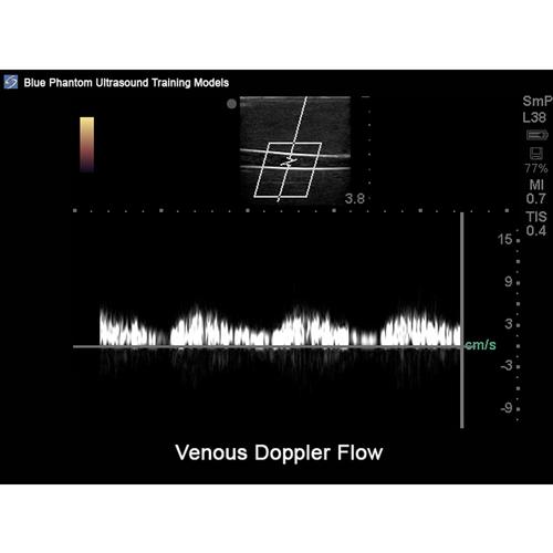 Blue Phantom Peripheral Doppler Ultrasound Training Model - 3012503 ...