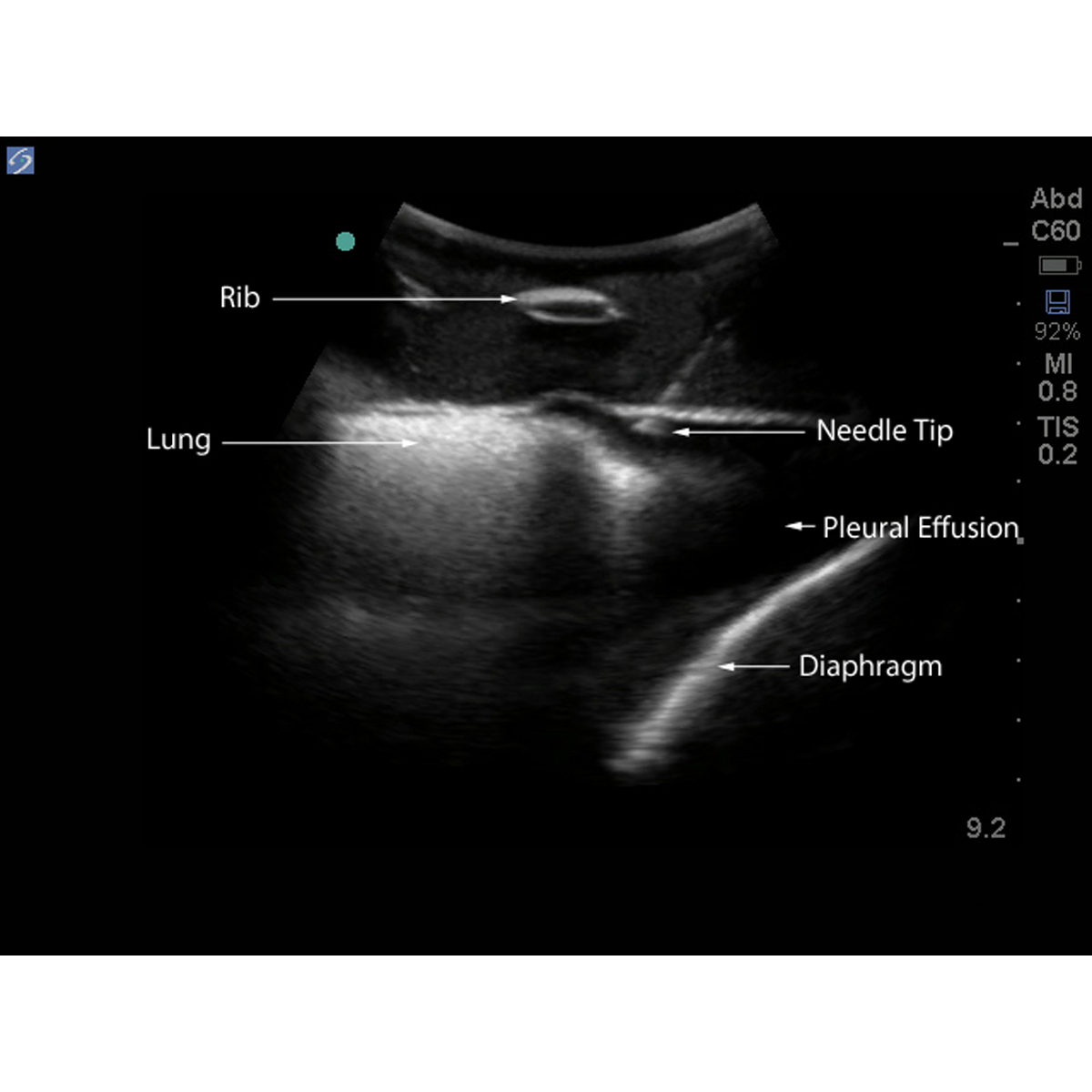 Blue Phantom Midscapular Thoracentesis Ultrasound Training Model ...