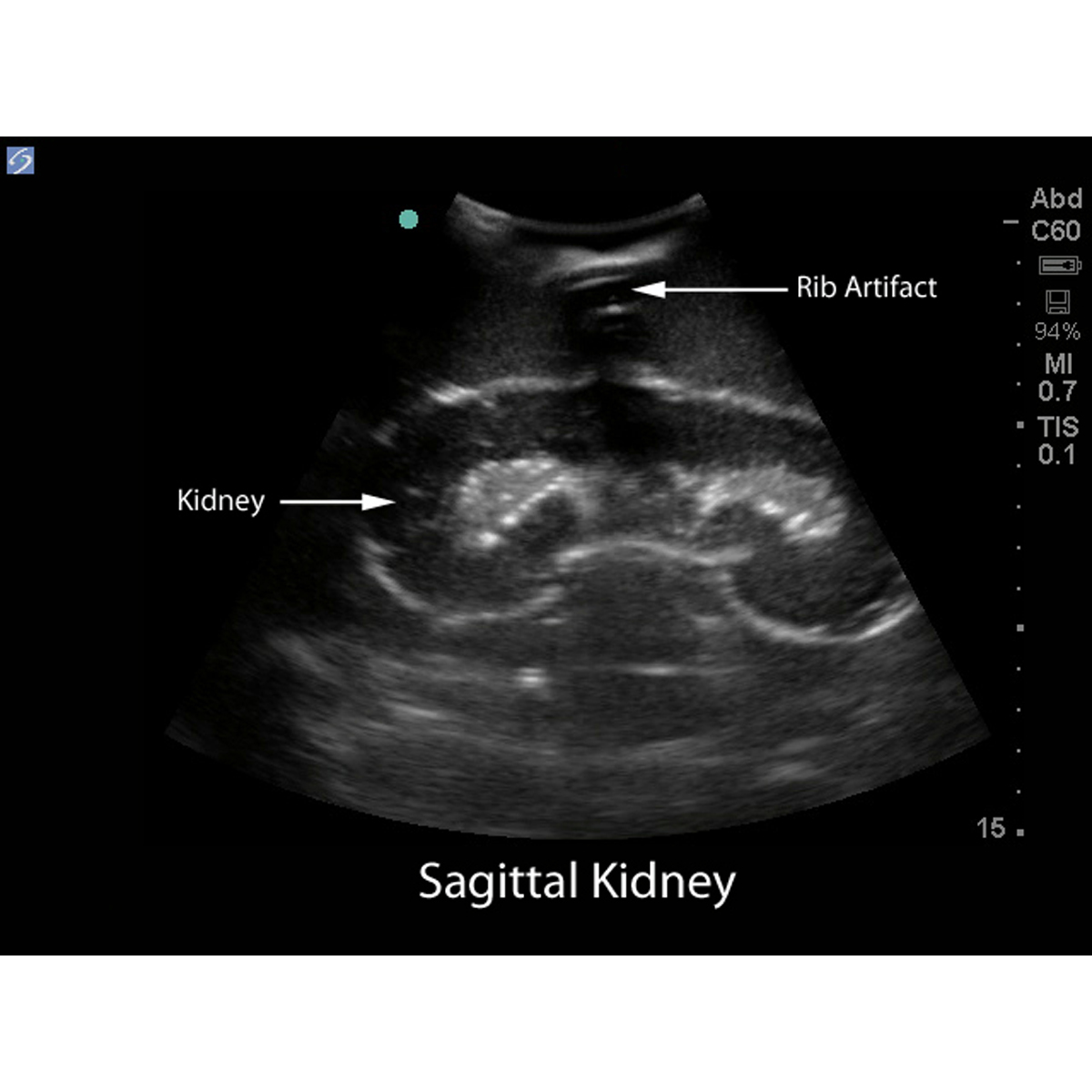 Blue Phantom Renal Biopsy Ultrasound Training Model - 3012507 - CAE ...