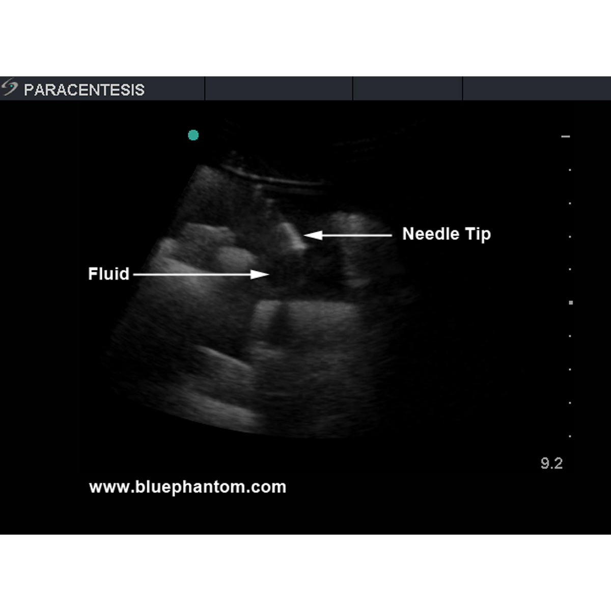 Blue Phantom Paracentesis Ultrasound Replacement Tissue Insert ...